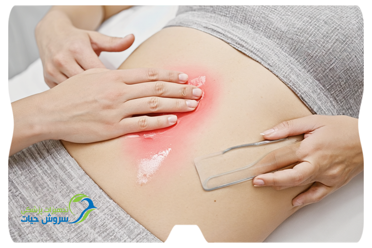 تجمع مایع بعد از لیپوساکشن