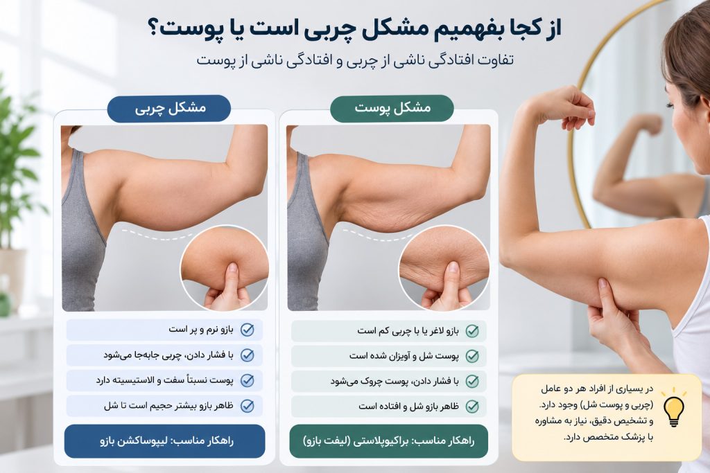 مقایسه افتادگی پوست و تجمع چربی بازو برای انتخاب روش درمان مناسب
