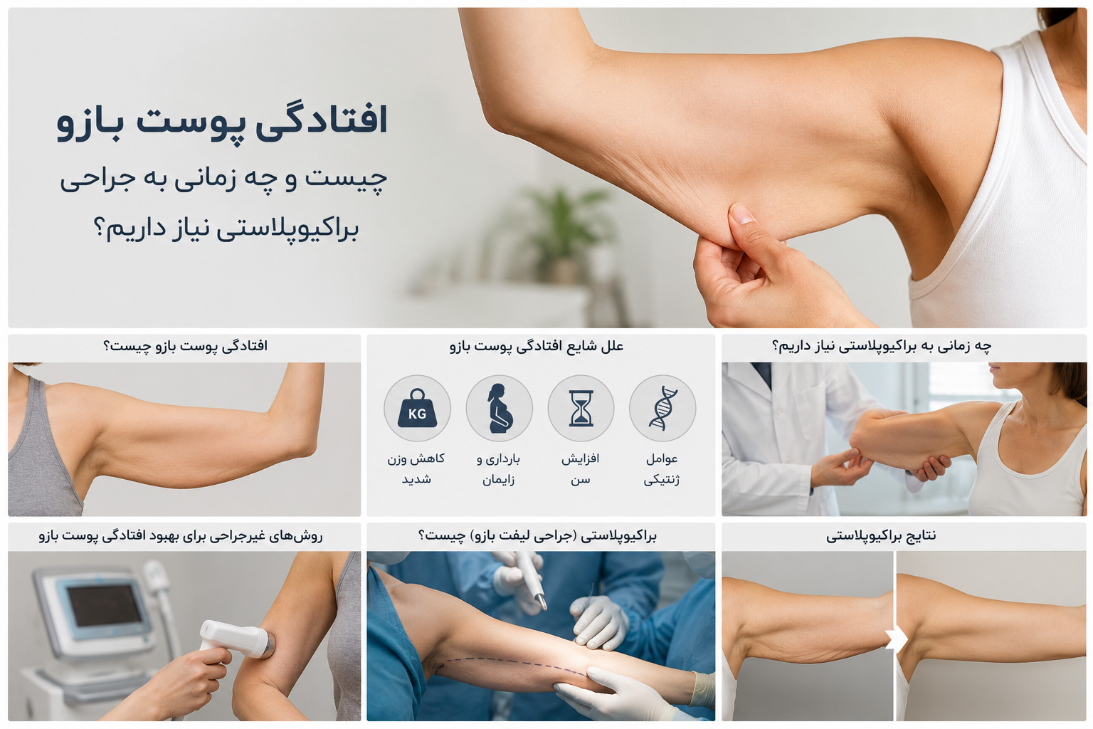 افتادگی پوست بازو و بررسی نیاز به جراحی براکیوپلاستی