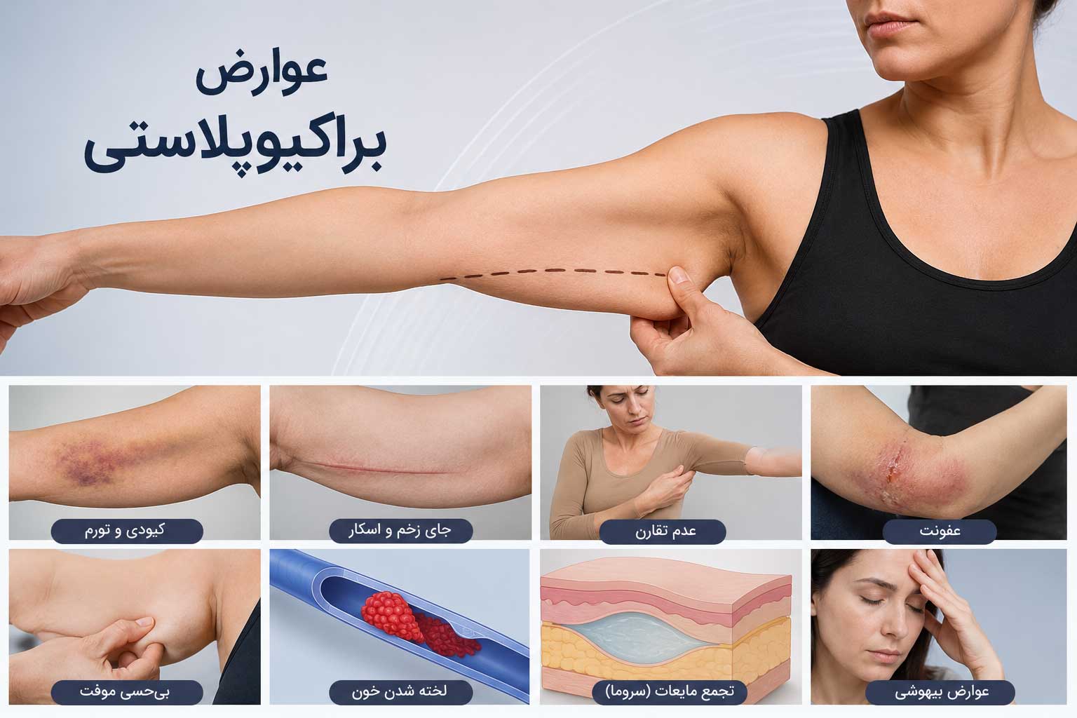 عوارض براکیوپلاستی شامل کبودی، تورم، اسکار و سایر عوارض احتمالی جراحی لیفت بازو