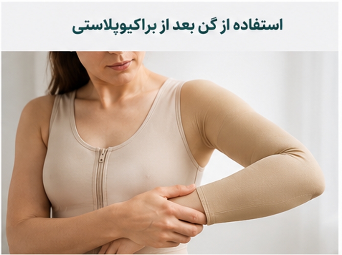 استفاده از گن بعد از براکیوپلاستی