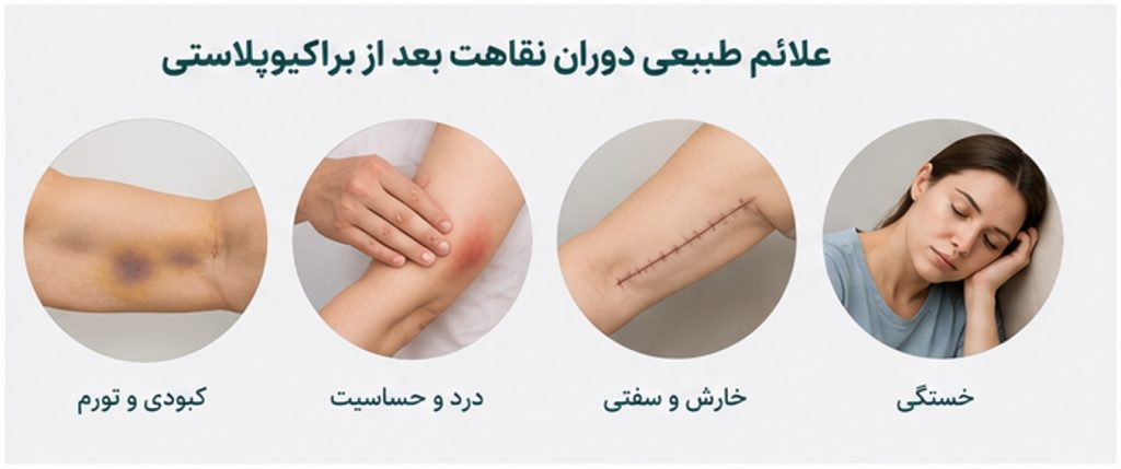 علائم طبیعی دوران نقاهت بعد از براکیوپلاستی