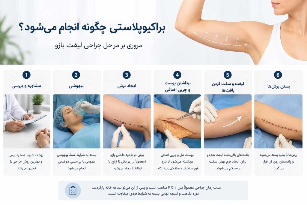 مراحل انجام جراحی براکیوپلاستی و نحوه لیفت بازو