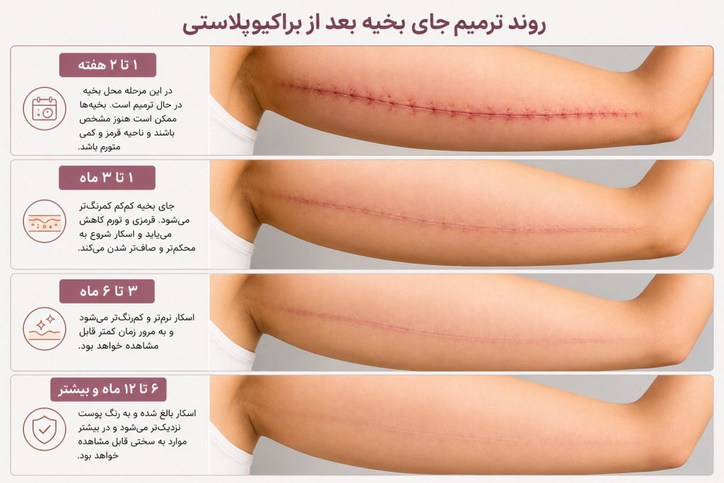 اینفوگرافیک روند ترمیم جای بخیه بعد از براکیوپلاستی