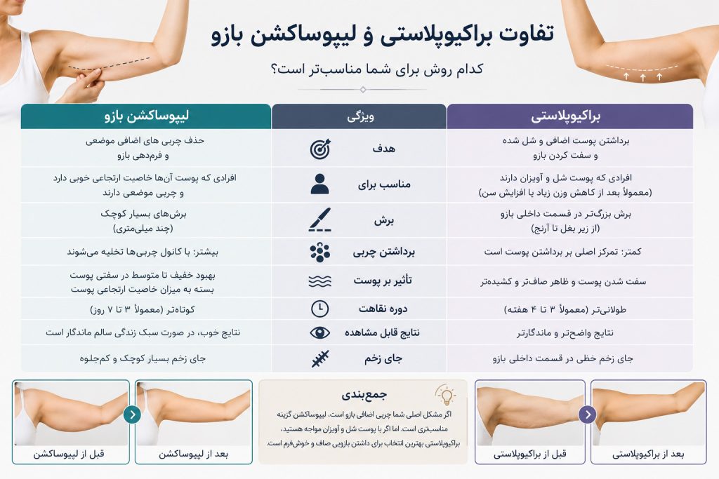مقایسه تفاوتهای براکیوپلاستی و لیپوساکشن بازو از نظر کاربرد، برش و نتایج