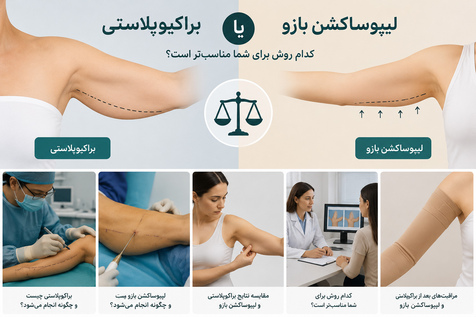 مقایسه براکیوپلاستی و لیپوساکشن بازو برای انتخاب بهترین روش فرمدهی بازو