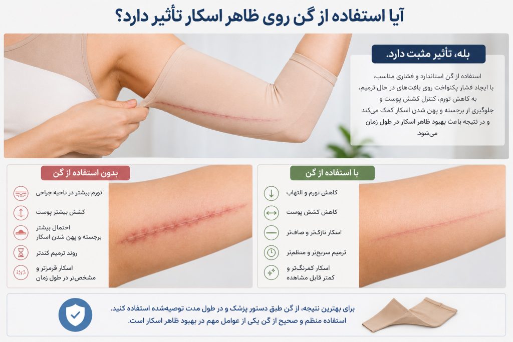 تأثیر گن طبی بر بهبود ظاهر اسکار بعد از براکیوپلاستی