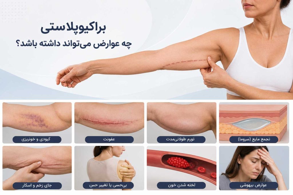 مهمترین عوارض احتمالی براکیوپلاستی مانند کبودی، عفونت، سروما، اسکار و بیحسی