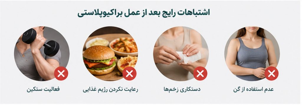 اشتباهات رایج بعد از عمل براکیوپلاستی