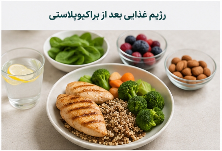 رژیم غذایی بعد از براکیوپلاستی